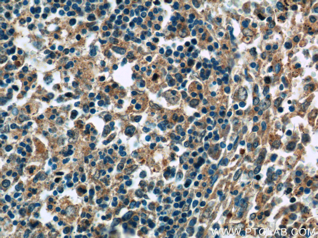 ERMP1 Polyclonal antibody