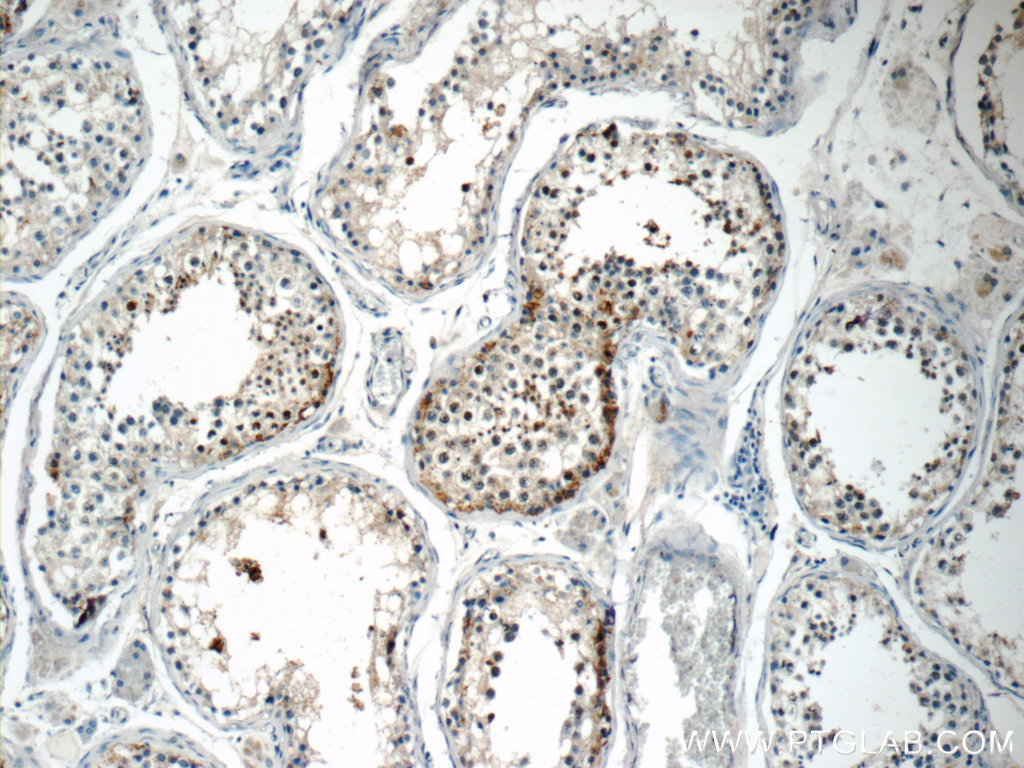 TSGA13 Polyclonal antibody
