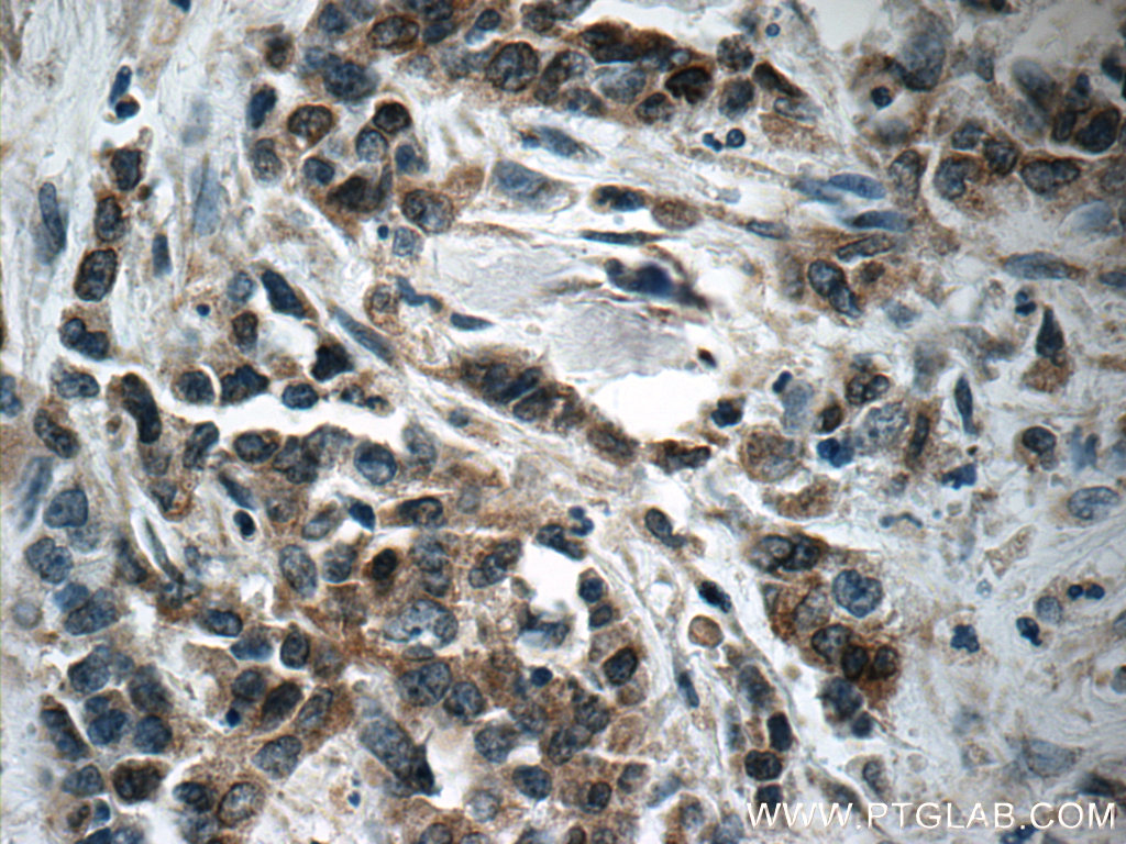 Pepsinogen I Polyclonal antibody