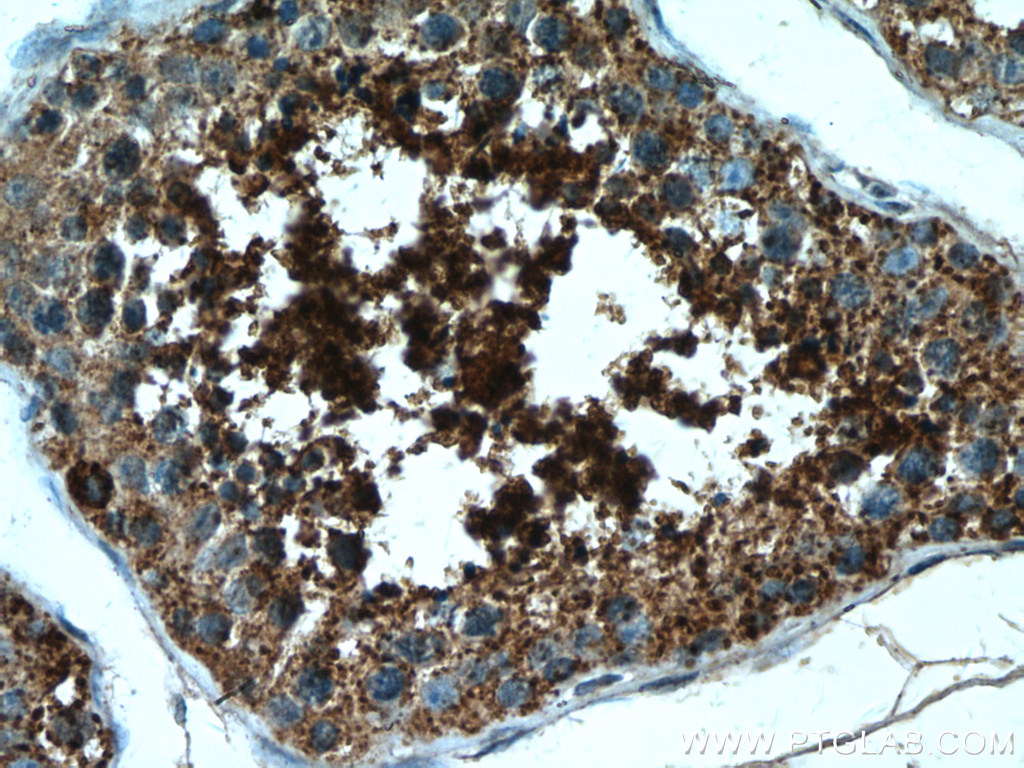 LIPE Polyclonal antibody