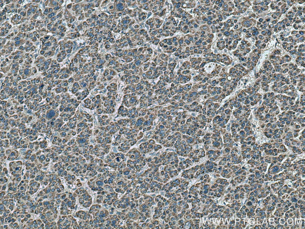 MEK4 Polyclonal antibody