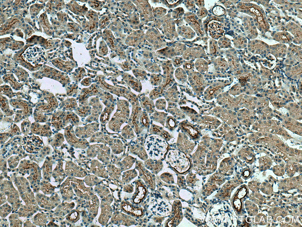 SLC5A10 Polyclonal antibody