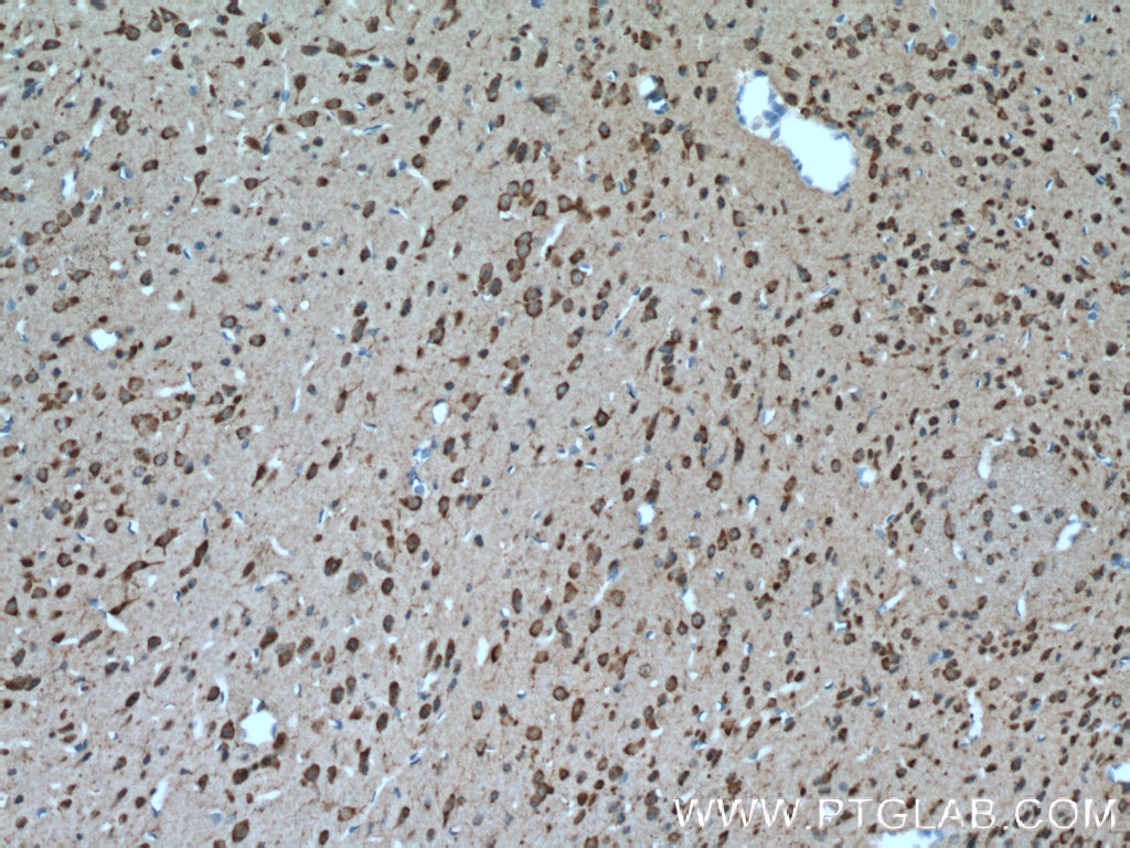 SLC25A18 Polyclonal antibody