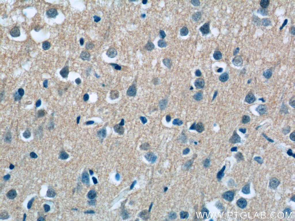 ASTN2 Polyclonal antibody