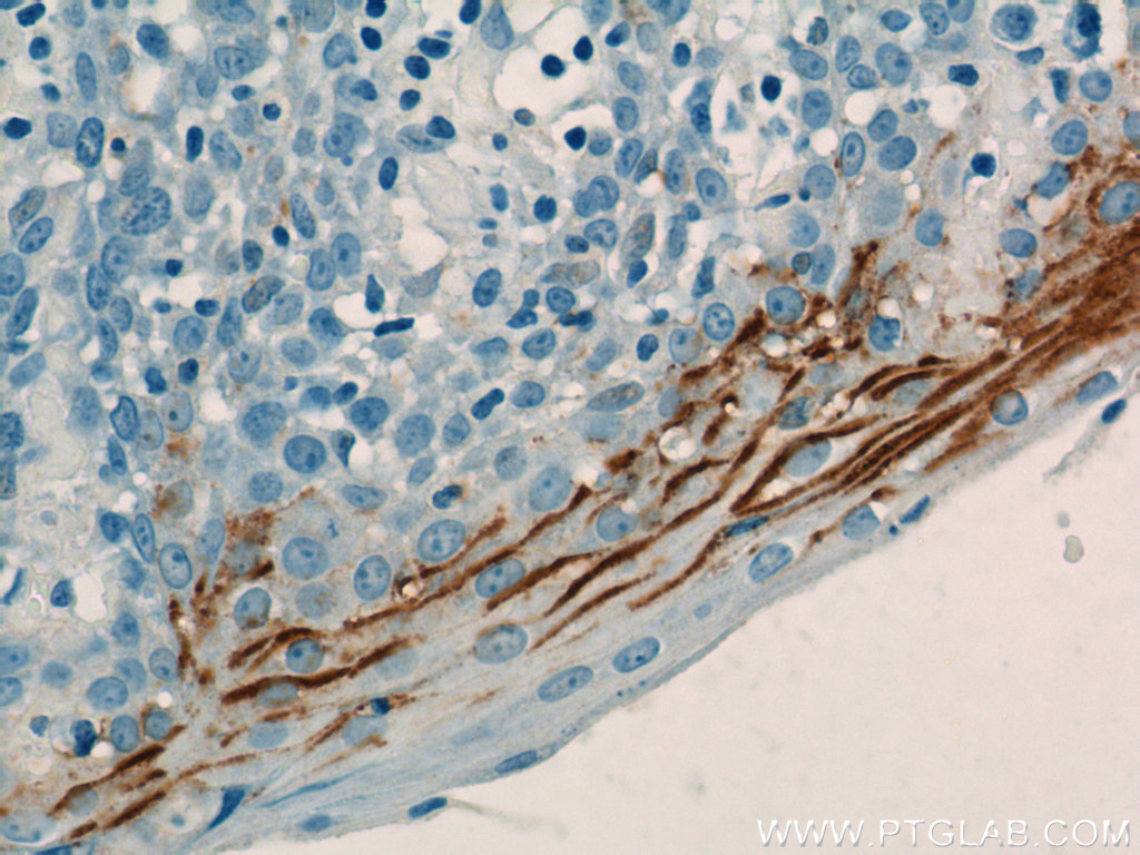 LY6D Polyclonal antibody