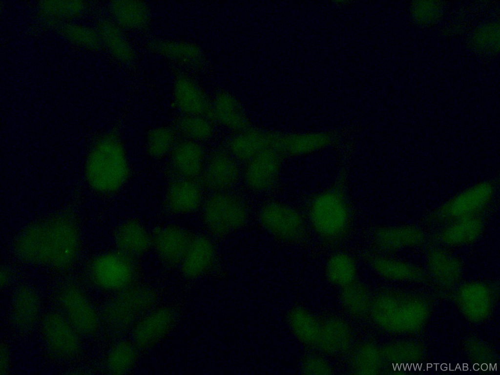 MAPK11 Polyclonal antibody