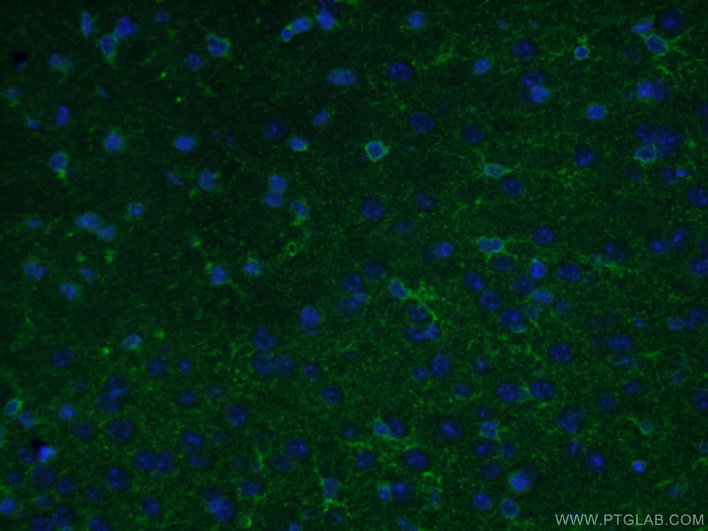 ALDH1L1 Polyclonal antibody