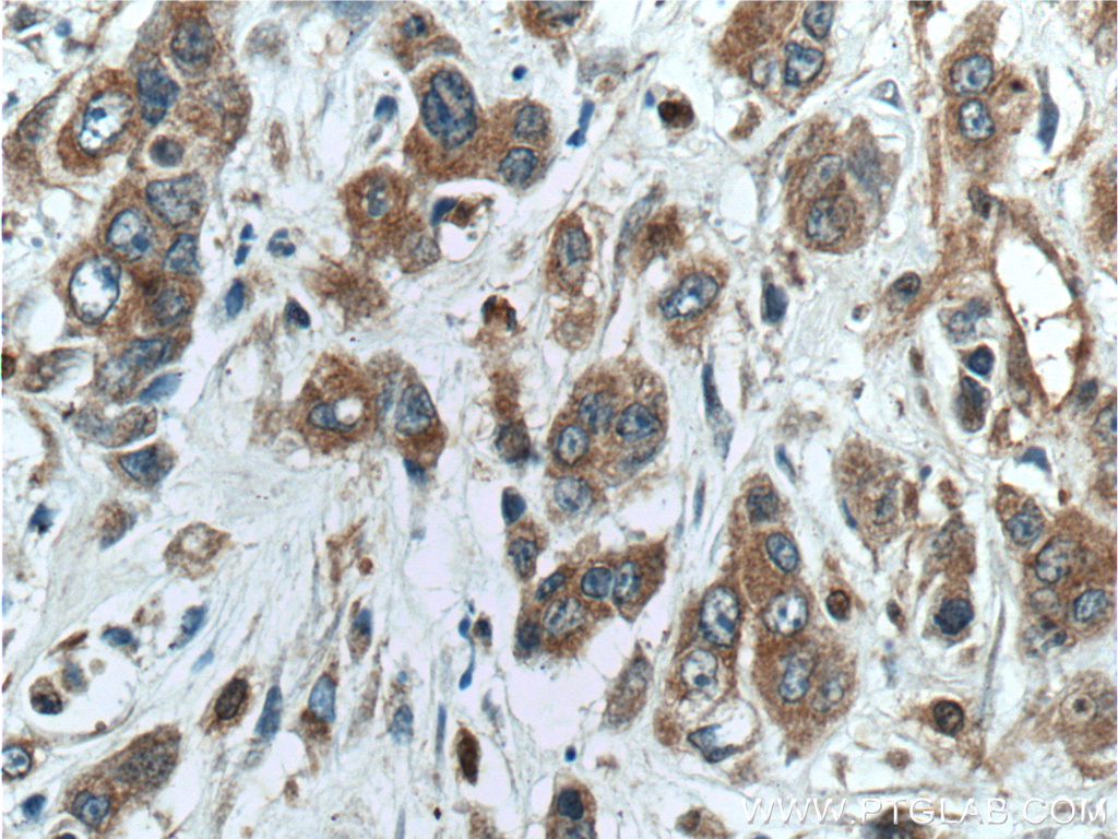 NUBPL Polyclonal antibody