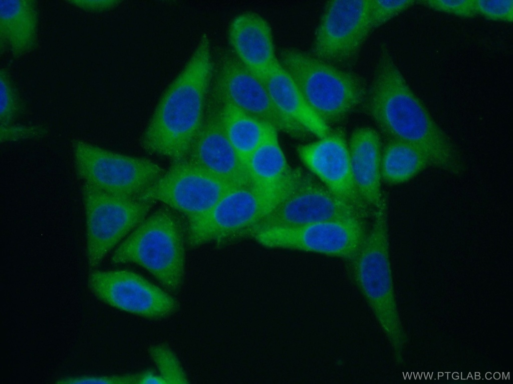AlaRS Polyclonal antibody