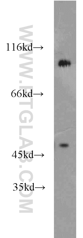 PSD2 Polyclonal antibody