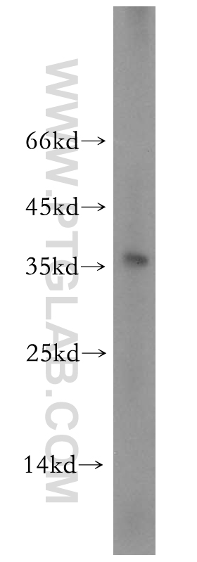 TGIF2LX Polyclonal antibody