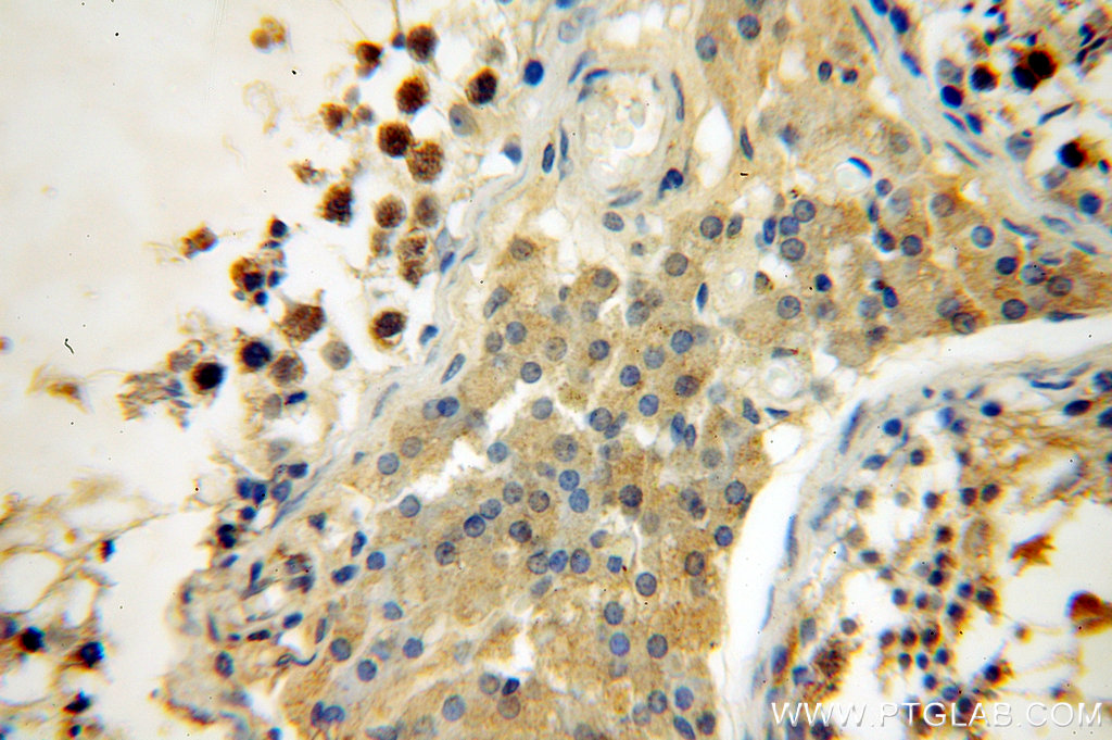 SYCE1 Polyclonal antibody