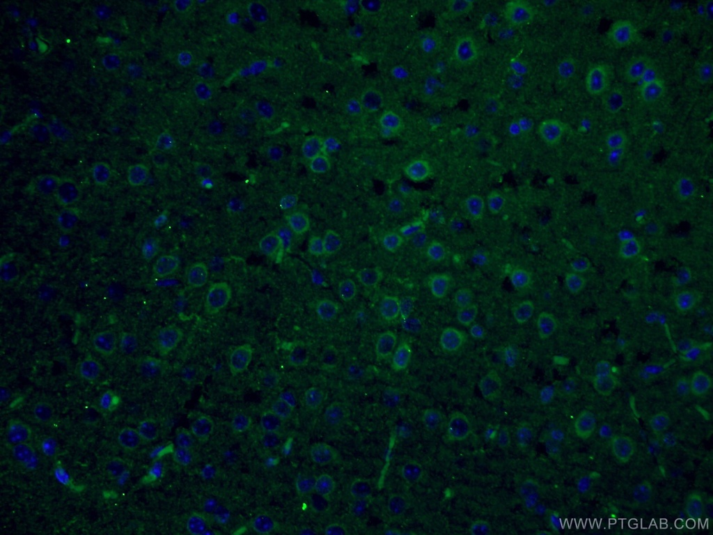PLCL2 Polyclonal antibody