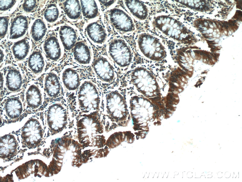 Oligophrenin 1 Polyclonal antibody