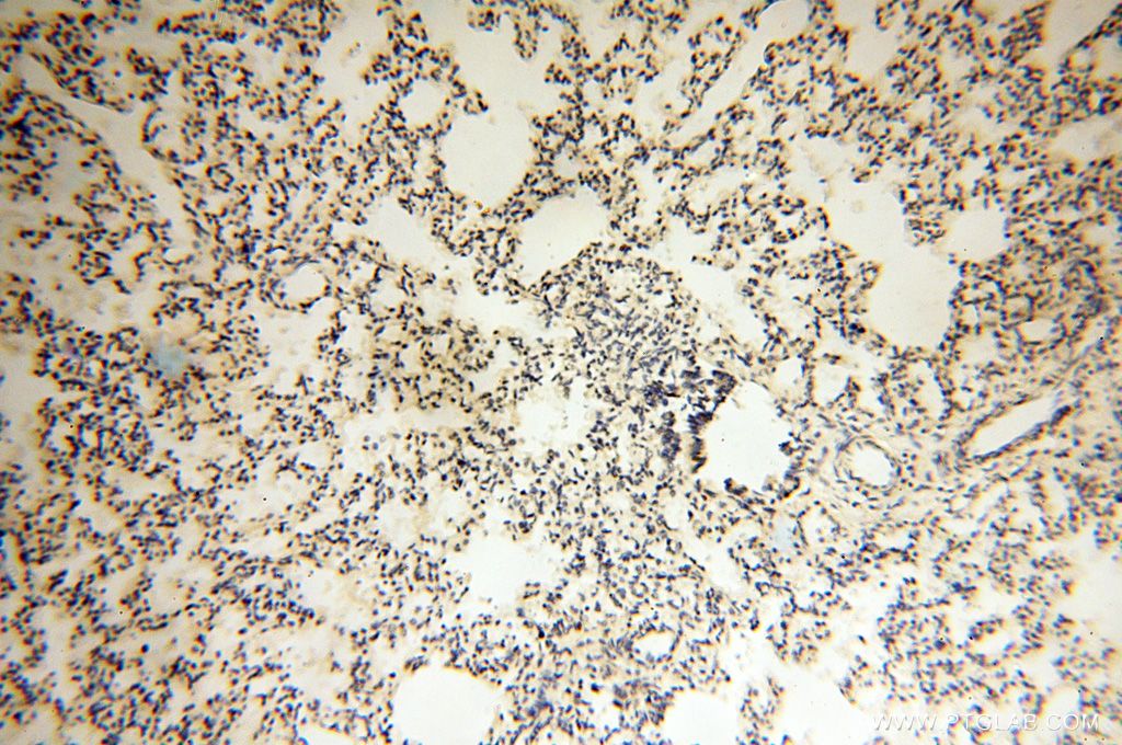 LCORL Polyclonal antibody