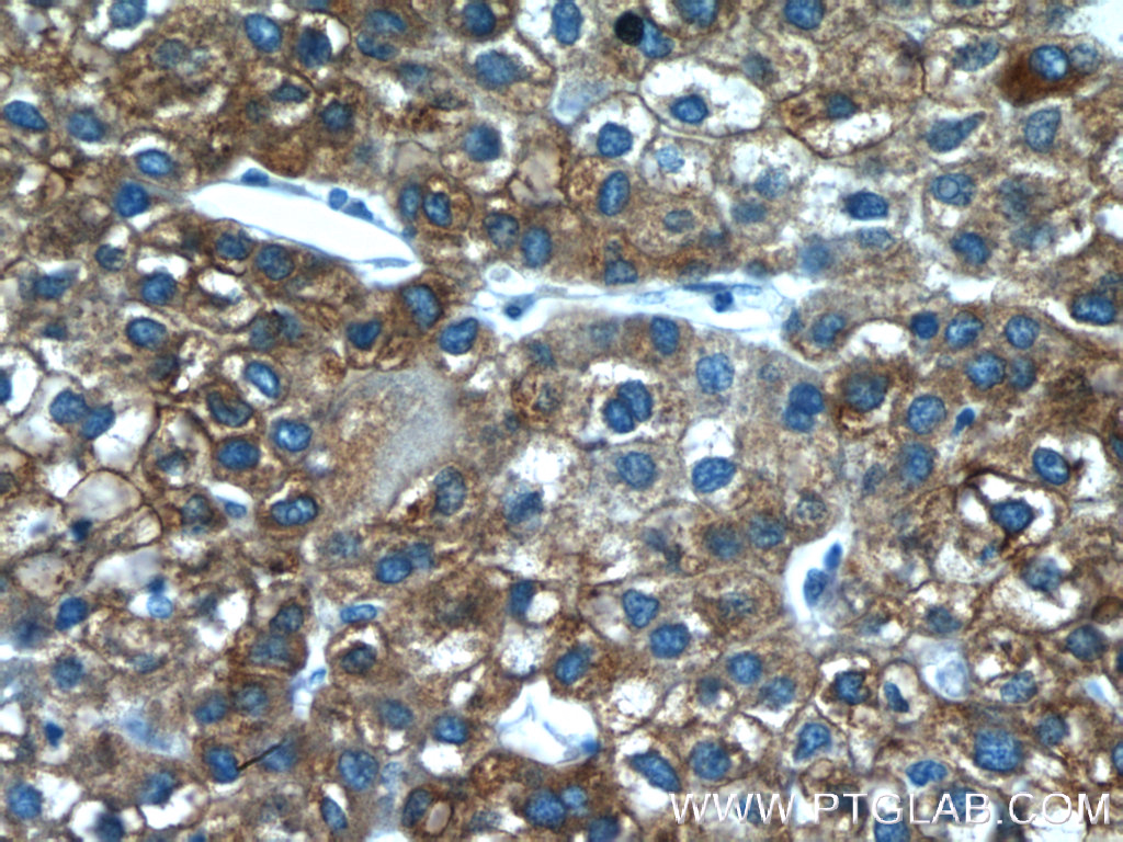 FMO3 Polyclonal antibody