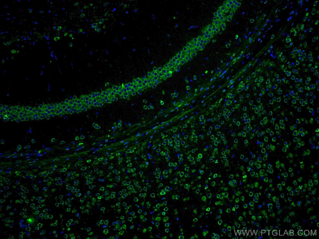 YTHDF1 Polyclonal antibody