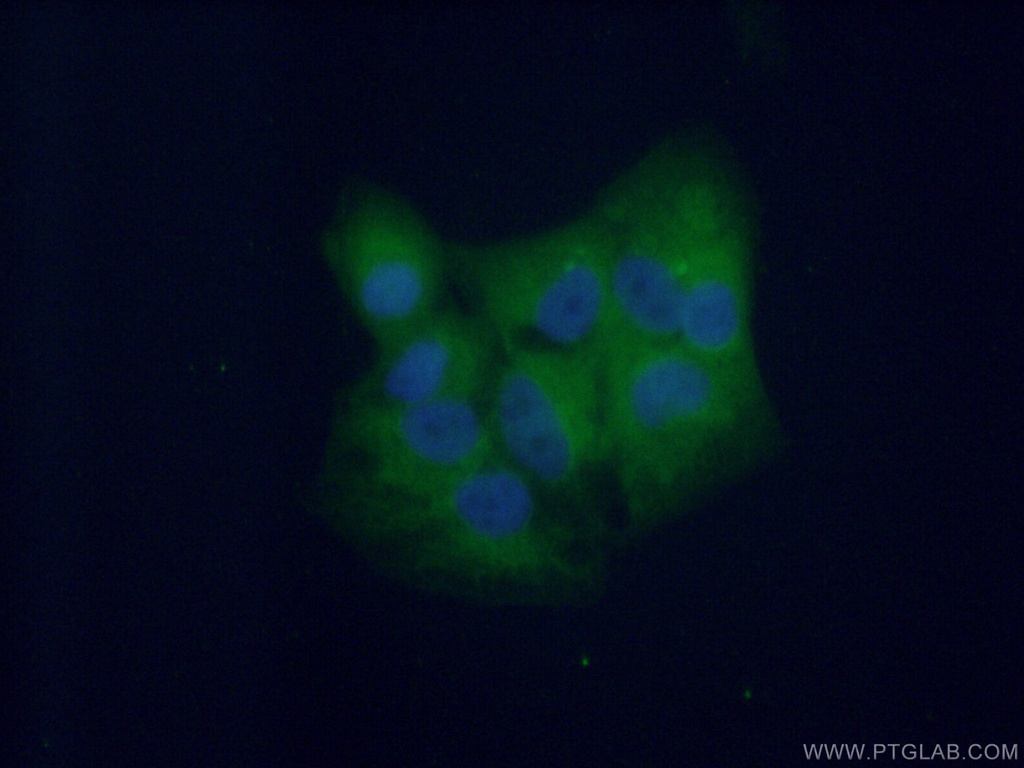 DTD1 Polyclonal antibody