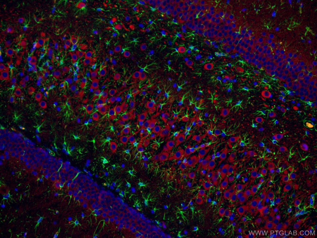 MAP2 Polyclonal antibody