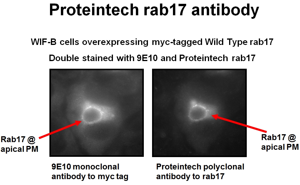RAB17 Polyclonal antibody