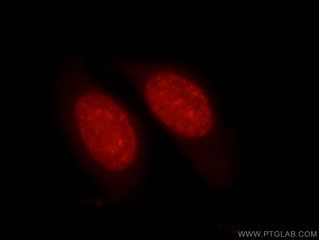 Histone H1.0 Polyclonal antibody