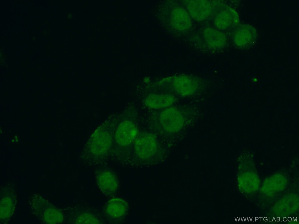 CTDSPL2 Polyclonal antibody