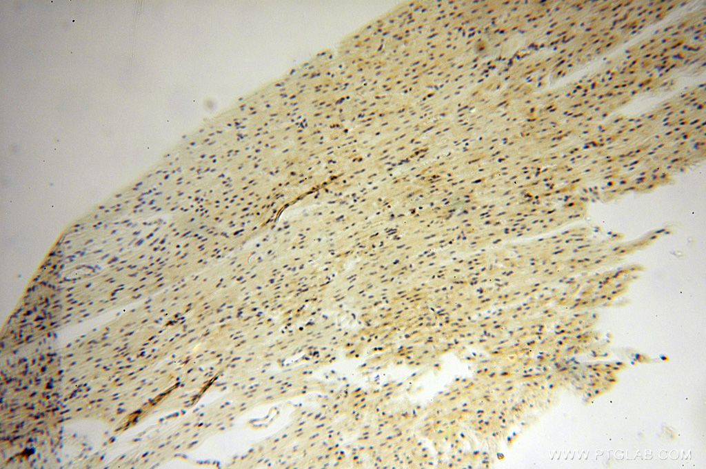 DNAI2 Polyclonal antibody