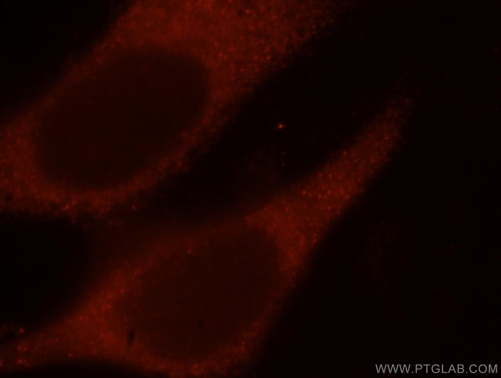 IFT52 Polyclonal antibody