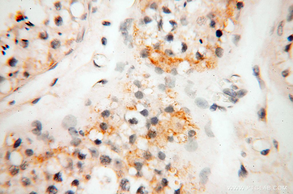 TRIM29 Polyclonal antibody