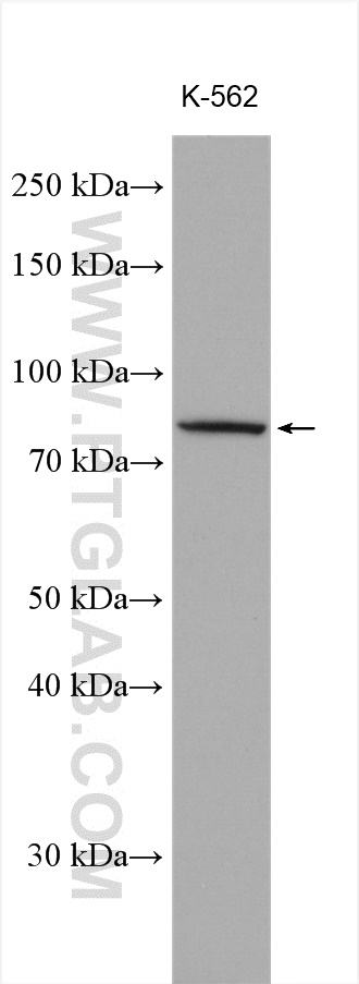 MTMR12 Polyclonal antibody