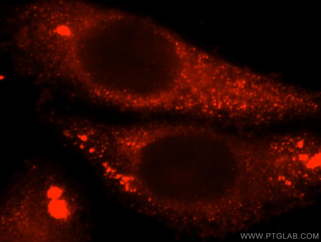 Calpain 9 Polyclonal antibody