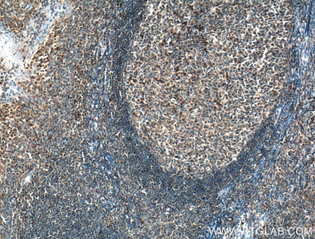 WDFY4 Polyclonal antibody