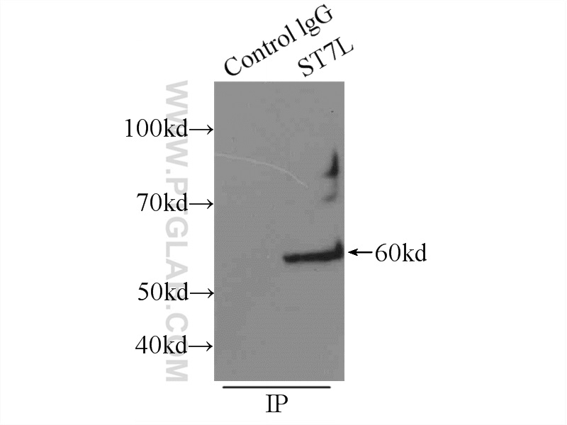 ST7L Polyclonal antibody