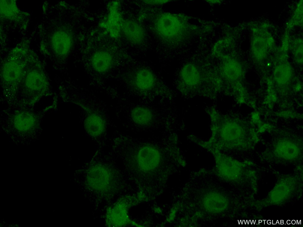 ACAP3 Polyclonal antibody