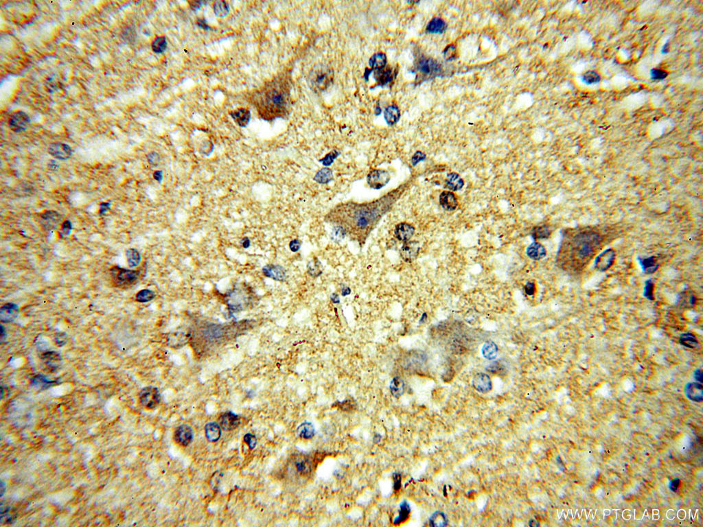 MCTP2 Polyclonal antibody