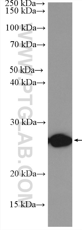 TNF Alpha Polyclonal antibody