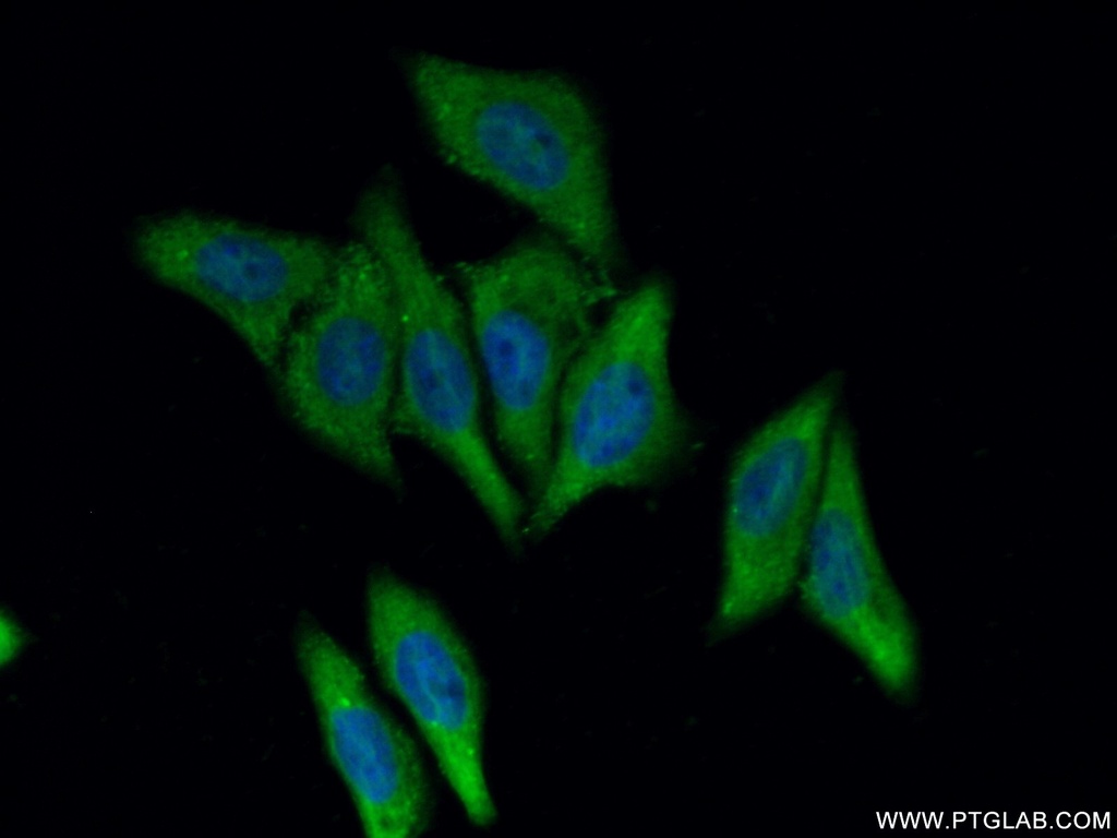 SMYD4 Polyclonal antibody