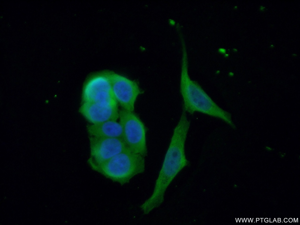 CDAN1 Polyclonal antibody
