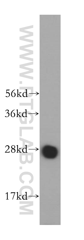 MED20 Polyclonal antibody