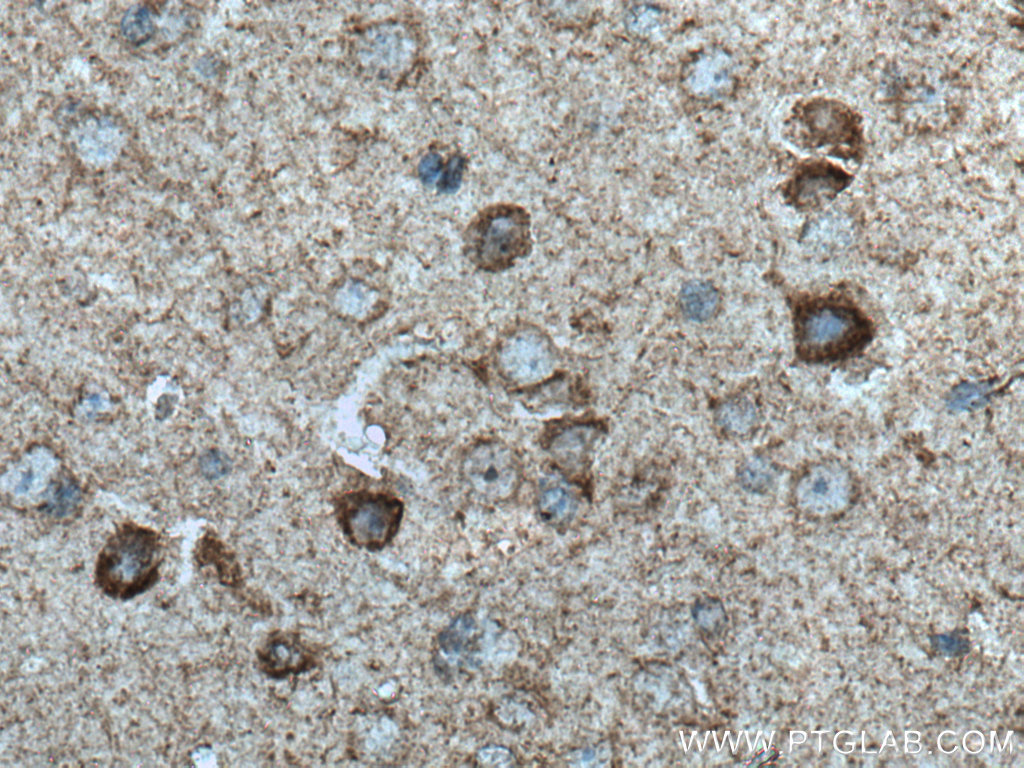 NDUFB2 Polyclonal antibody