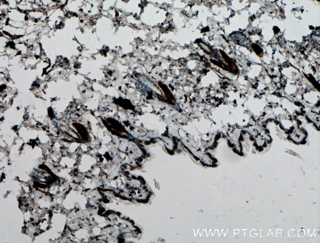 IL-21 Polyclonal antibody