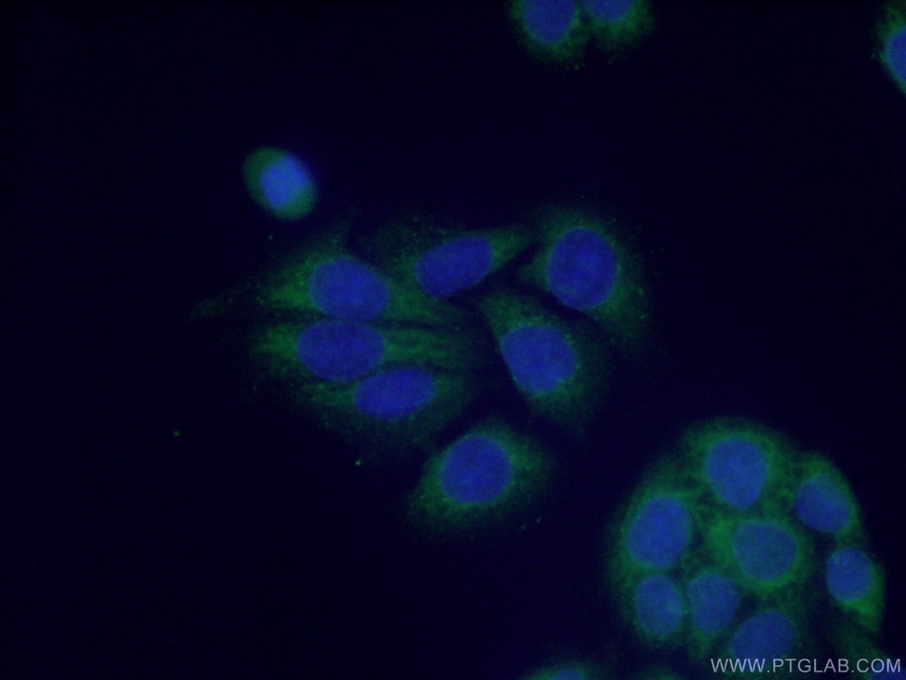 PRMT3 Polyclonal antibody