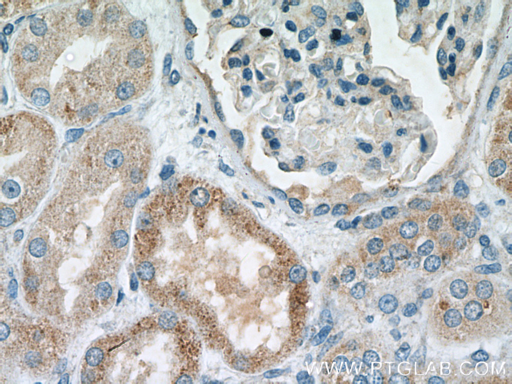MSRB2 Polyclonal antibody