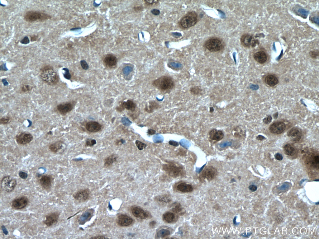 RORB Polyclonal antibody