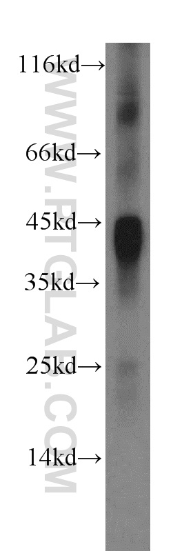IL-12B Polyclonal antibody