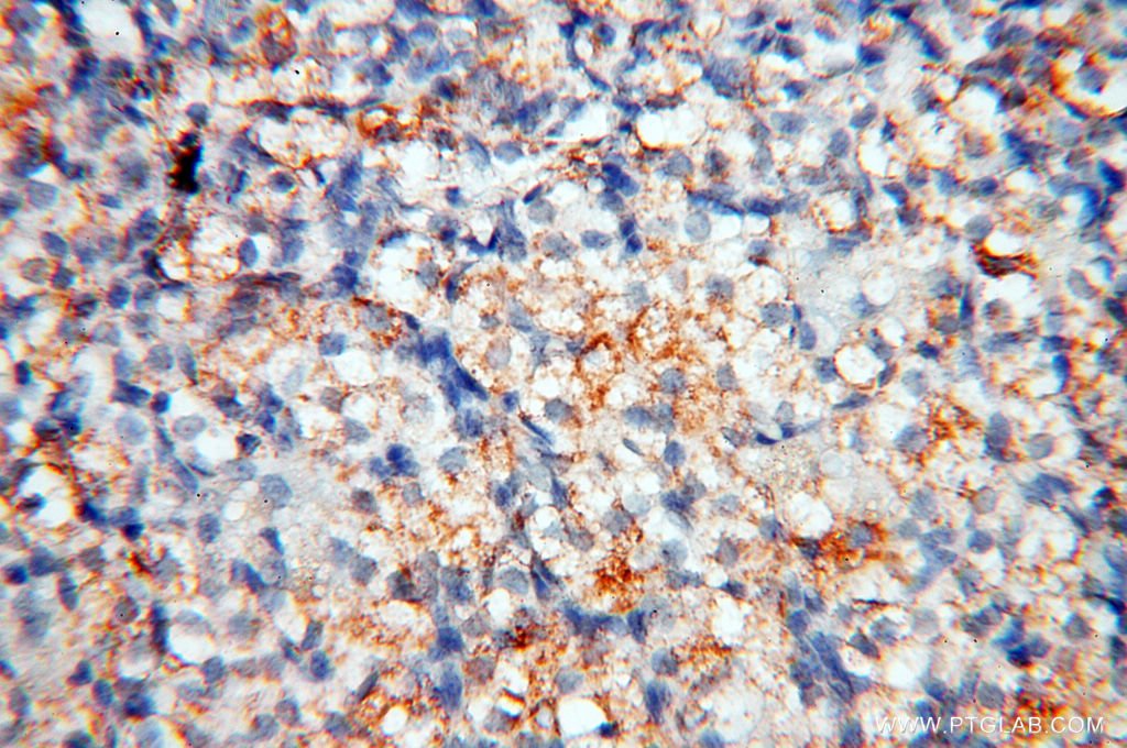 MFAP4 Polyclonal antibody