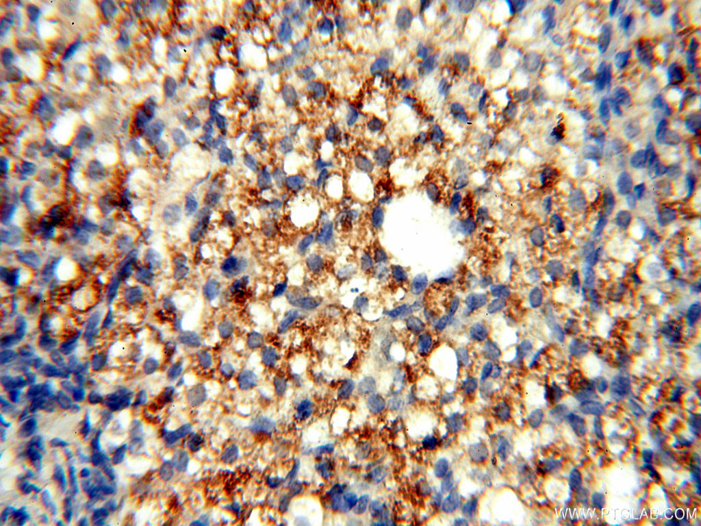 TYW1B Polyclonal antibody