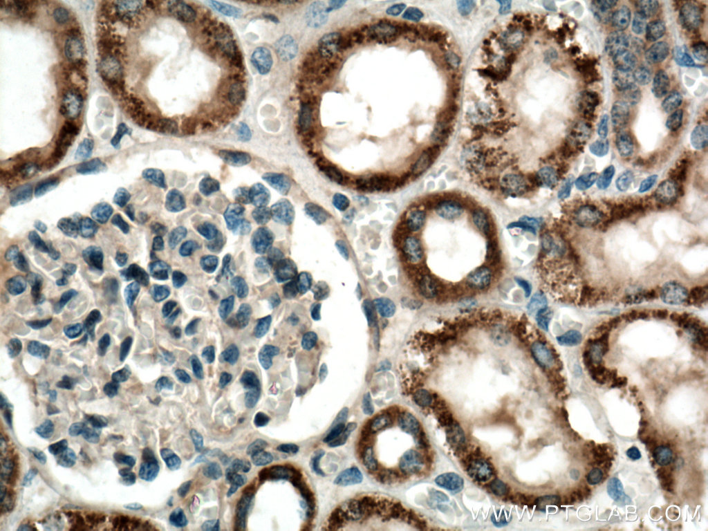 JAK2 Polyclonal antibody