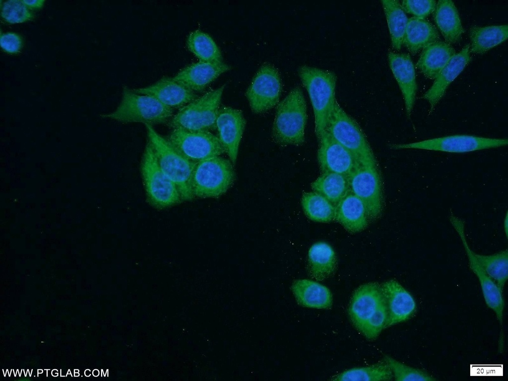 SH3BP4 Polyclonal antibody