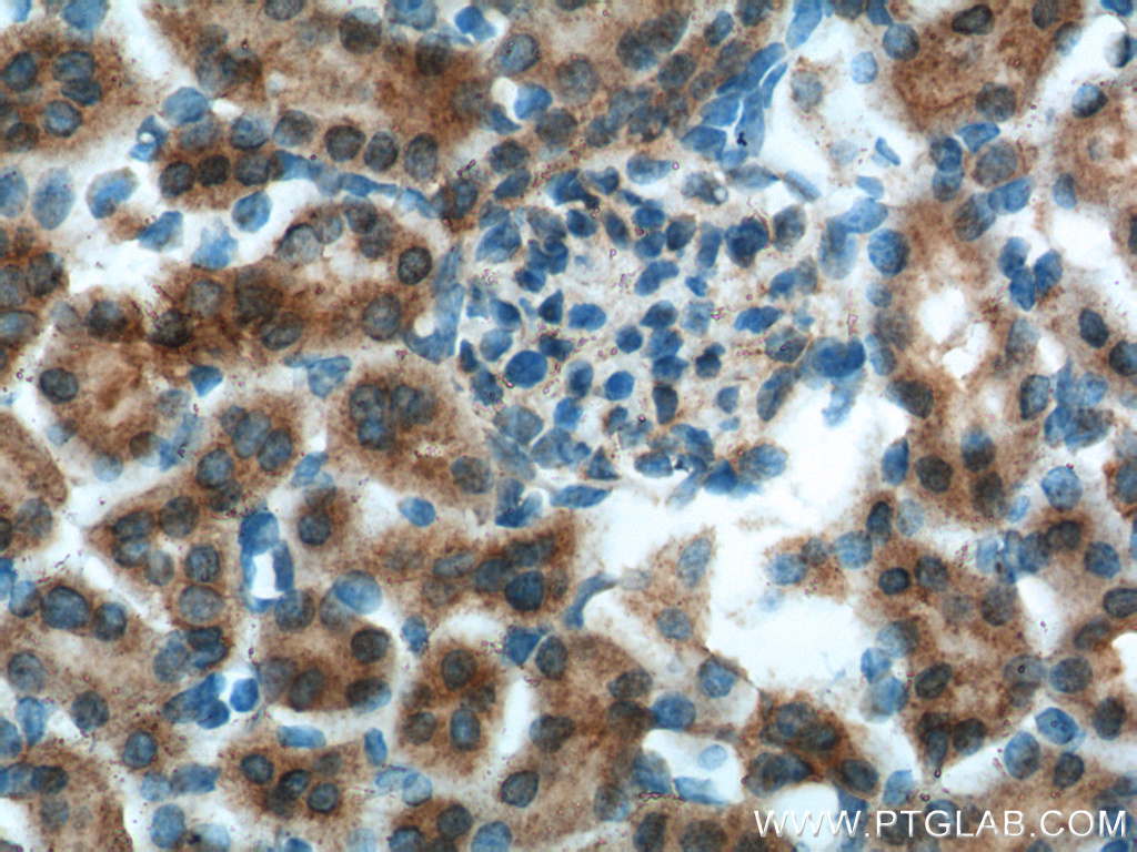 OCRL Polyclonal antibody